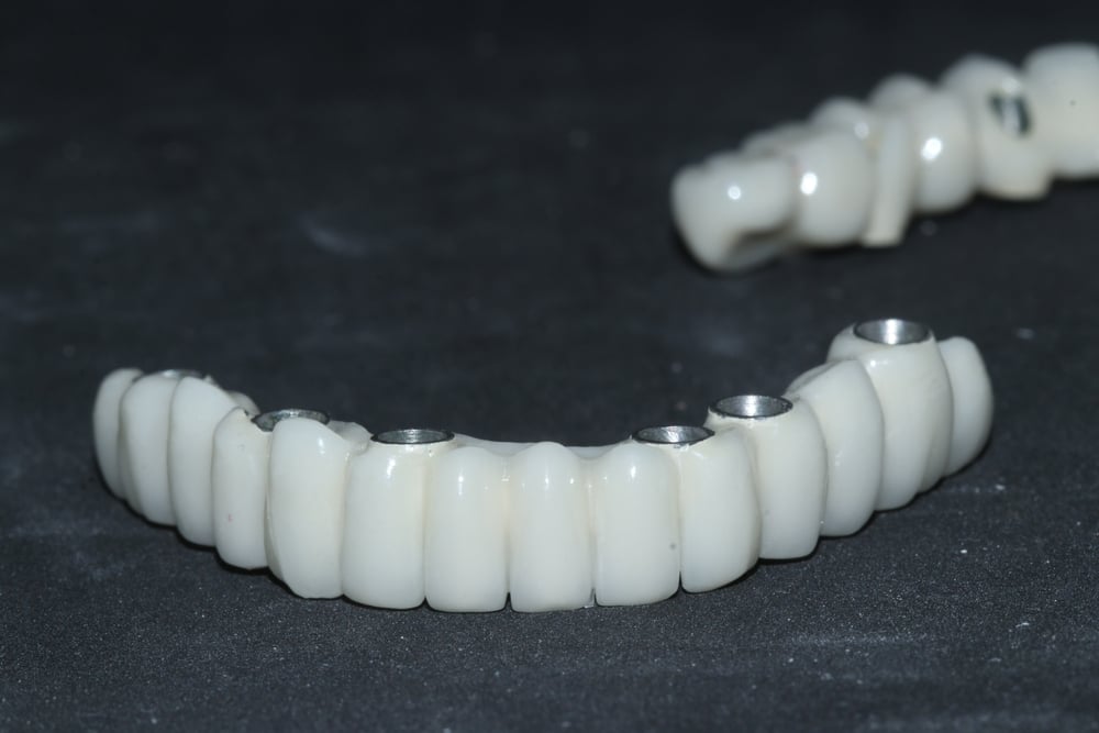 Implant-Supported Dentures Vacaville